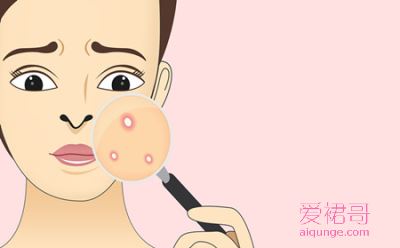 消除青春痘美丽洗脸法