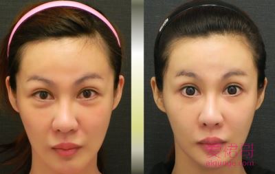 应该进入精致护理的年龄了