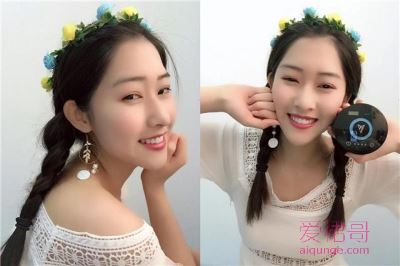 冷光美白牙齿会不会伤害牙龈